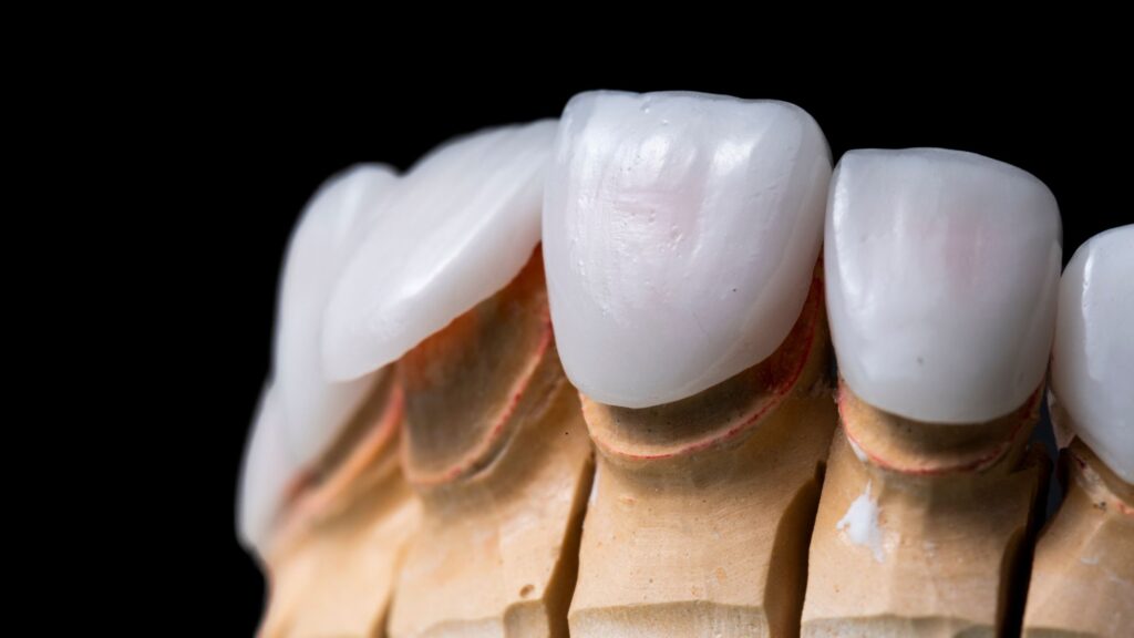 Dental design costa rica