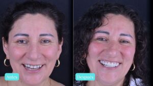 Restaurativa dental DC Dental