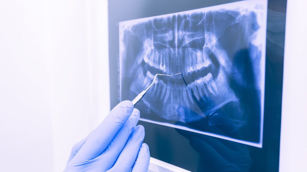 Paso a paso en odontología estética