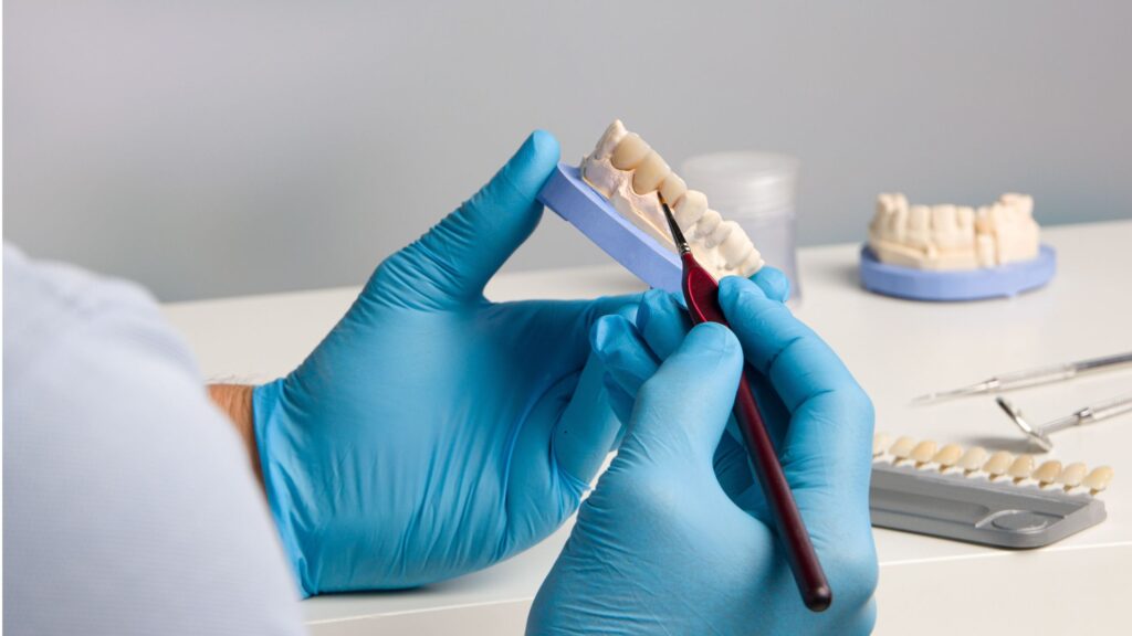 Casos odontología estética