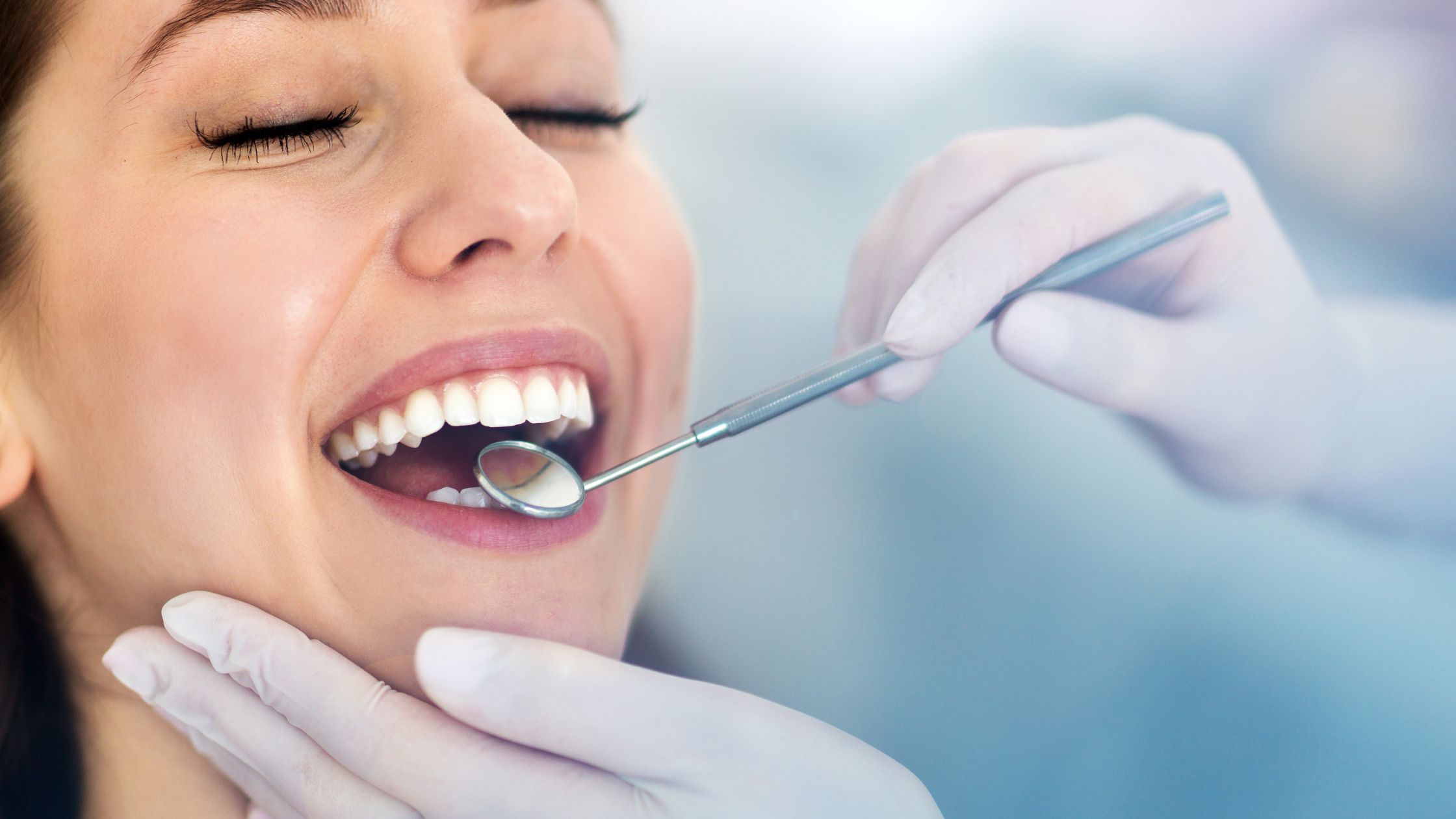 Blanqueamiento dental profesional
