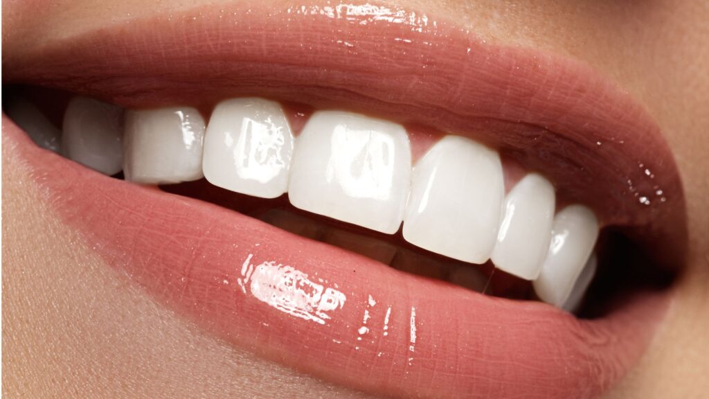 Restaurativa dental completa costa rica