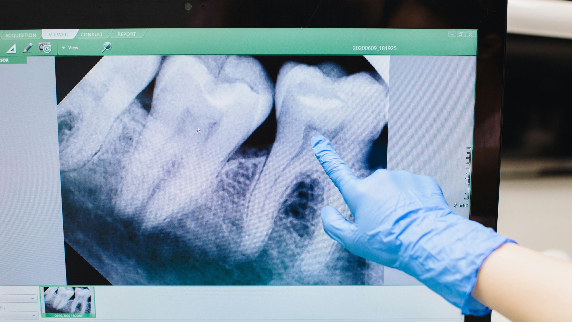 Soluciones restaurativas DC Dental