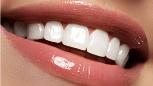 Restaurativa dental completa costa rica