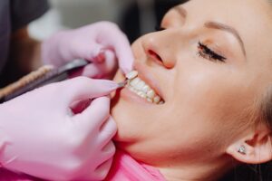 CARILLAS DENTALES NATURALES CLINICA DENTA HEREDIA