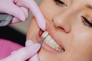 Opciones para reemplazar piezas dentales perdidas con implantes, puentes y prótesis dentales